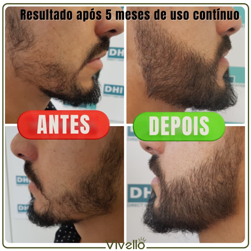 Balmoil - Óleo e Pomada Natural